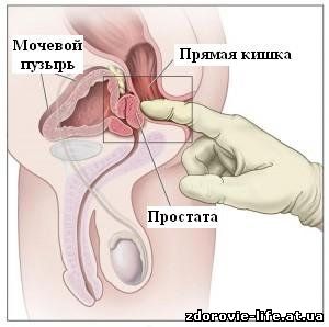 Внематочная беременность и ее причины Внематочная беременность и ее причины